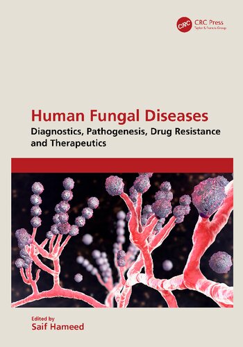 Human Fungal Diseases – Diagnostics, Pathogenesis, Drug Resistance and Therapeutics